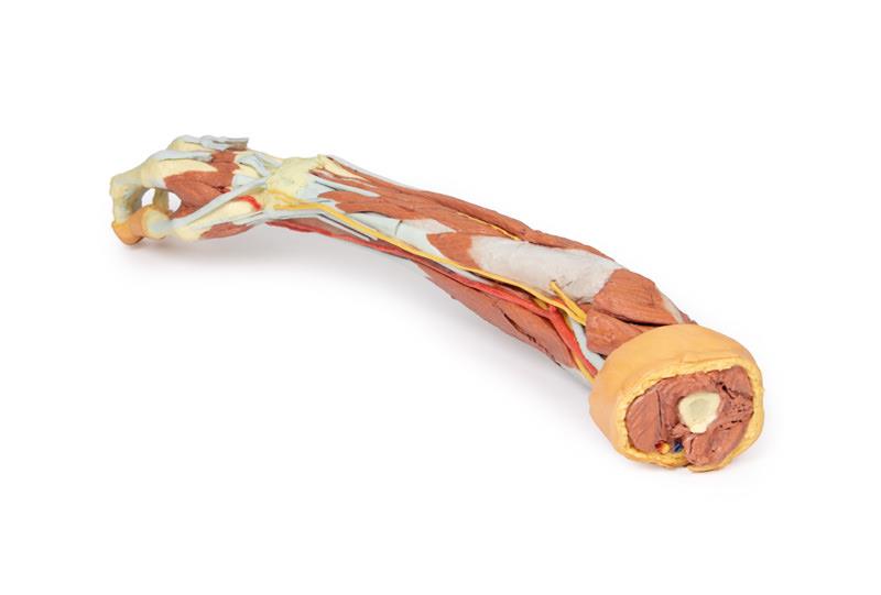 Deep upper limb and hand