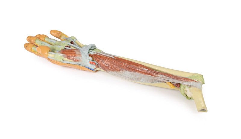 Forearm and hand - deep dissection - 3D Printed Cadaver