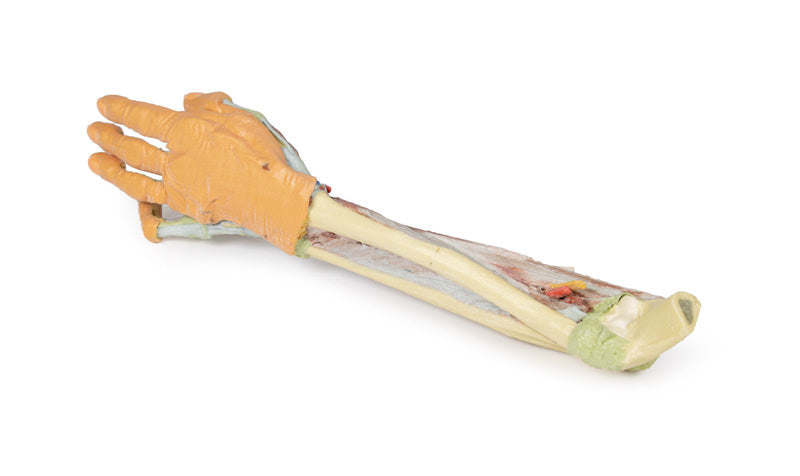 Forearm and hand - deep dissection - 3D Printed Cadaver