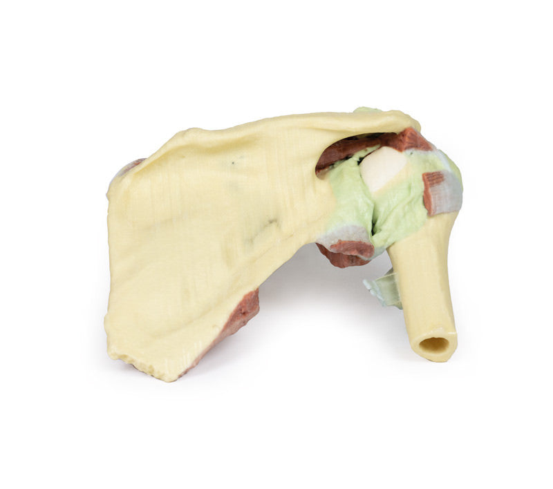 Shoulder - deep dissection of a right shoulder girdle, preserving a complete scapula, lateral clavicle, and proximal humerus - 3D Printed Cadaver