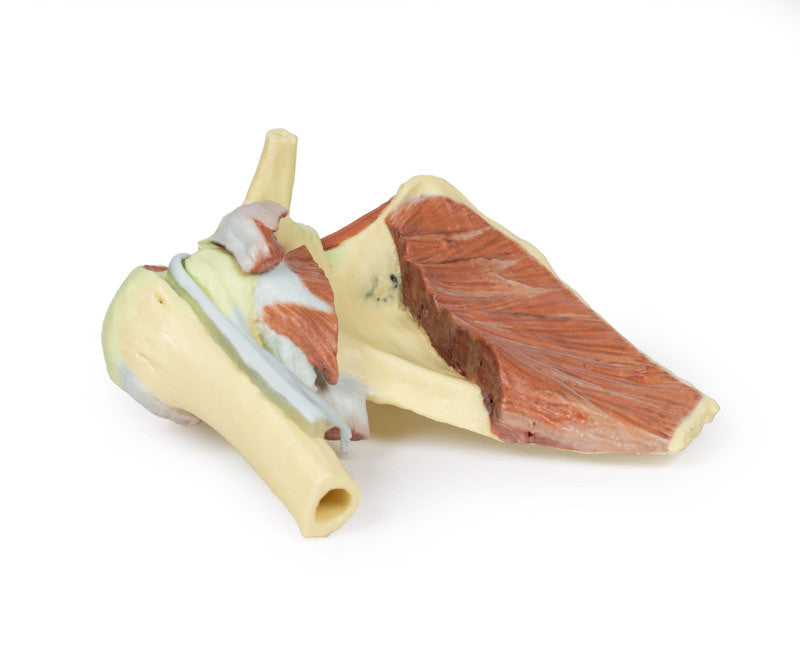 Shoulder - deep dissection of a right shoulder girdle, preserving a complete scapula, lateral clavicle, and proximal humerus - 3D Printed Cadaver