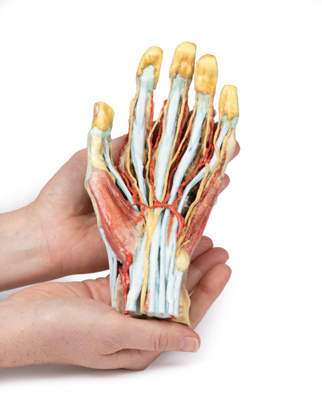 Hand Anatomy - 3D Printed Cadaver