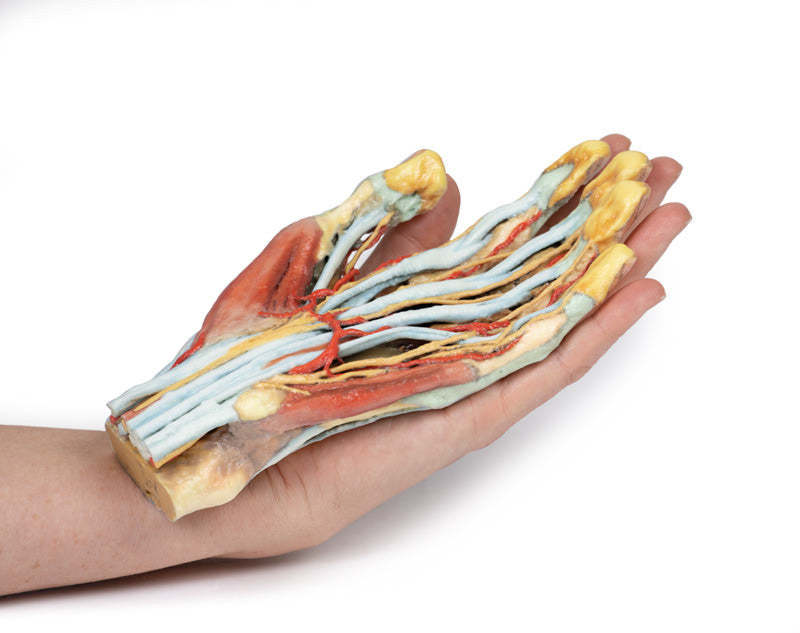 Hand Anatomy - 3D Printed Cadaver
