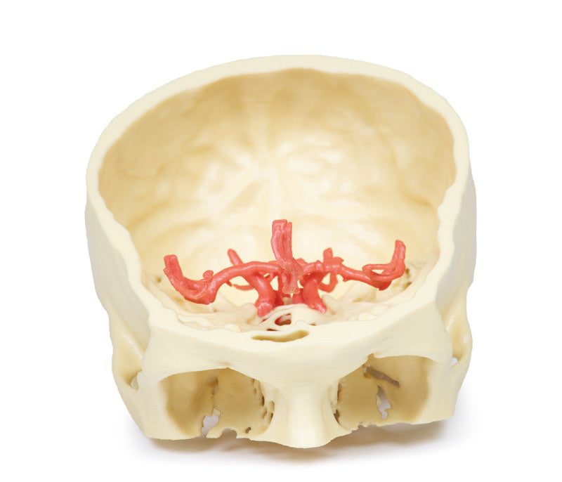 Circle of Willis - 3D Printed Cadaver