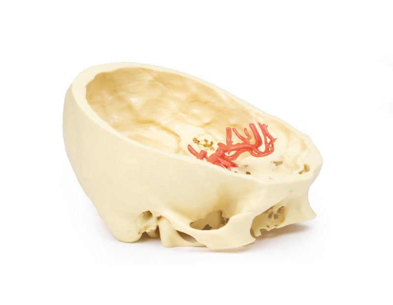 Circle of Willis - 3D Printed Cadaver