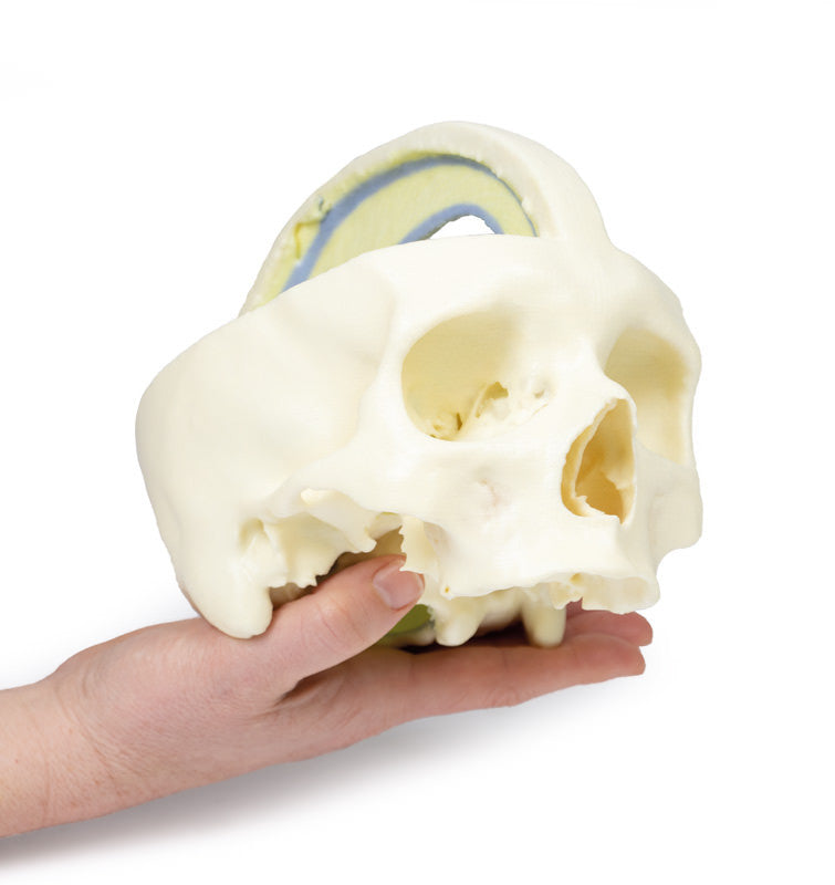 Dural Skull - 3D Printed Cadaver