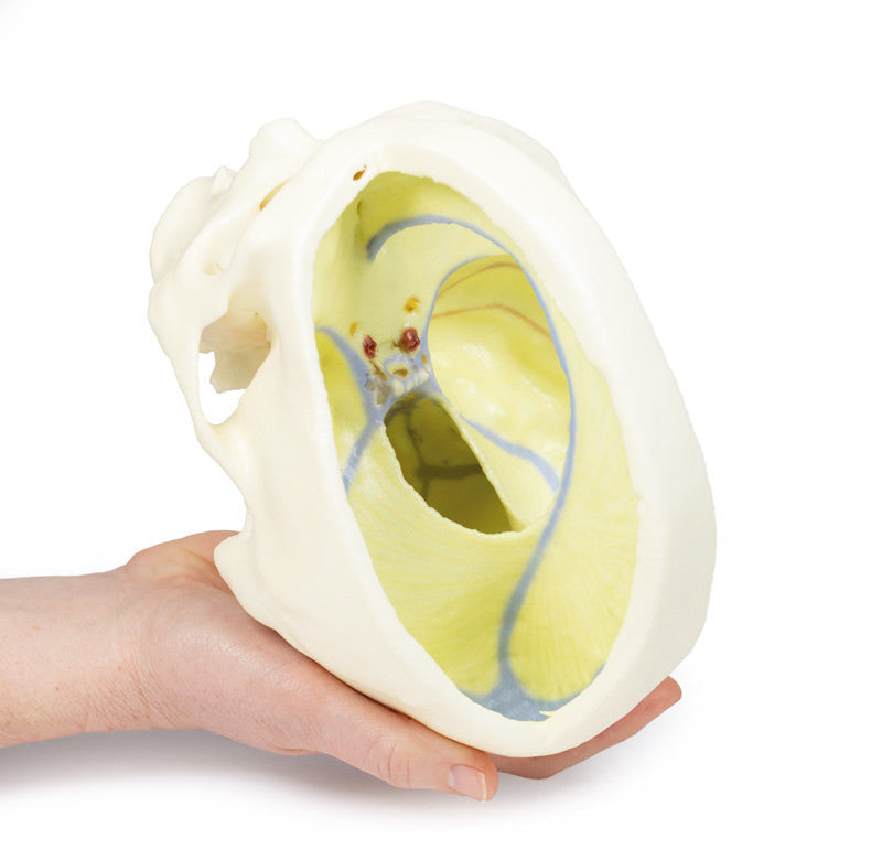 Dural Skull - 3D Printed Cadaver