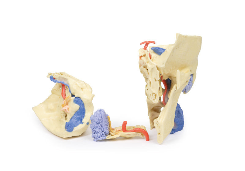 Temporal Bone Model, Set of 3 - 3D Printed Cadaver