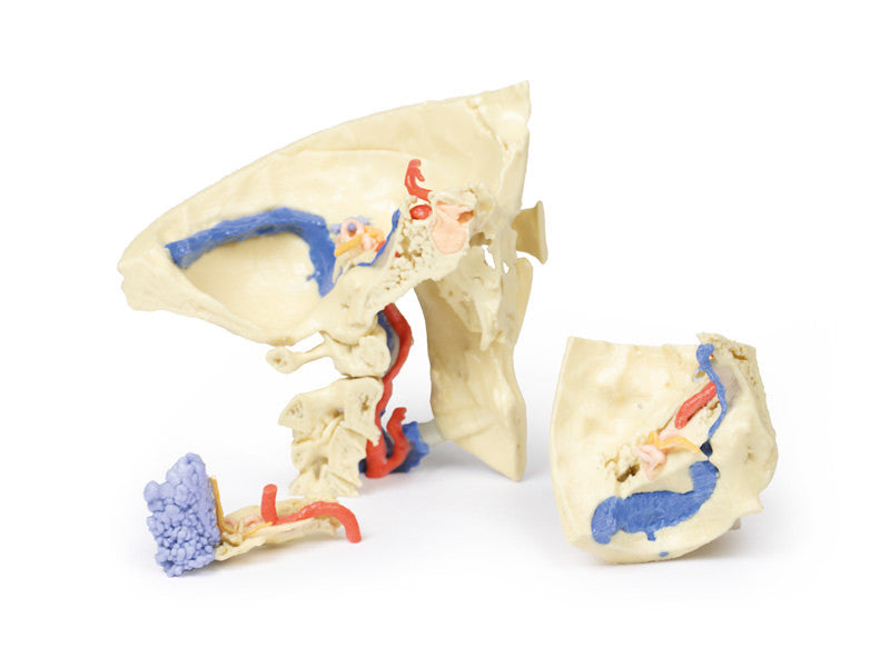 Temporal Bone Model, Set of 3 - 3D Printed Cadaver