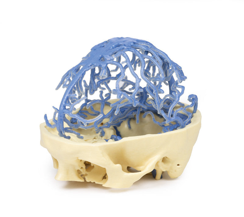 Venous Circulation | 3D Printed Cadaver