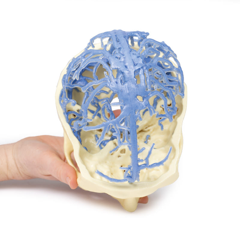 Venous Circulation | 3D Printed Cadaver
