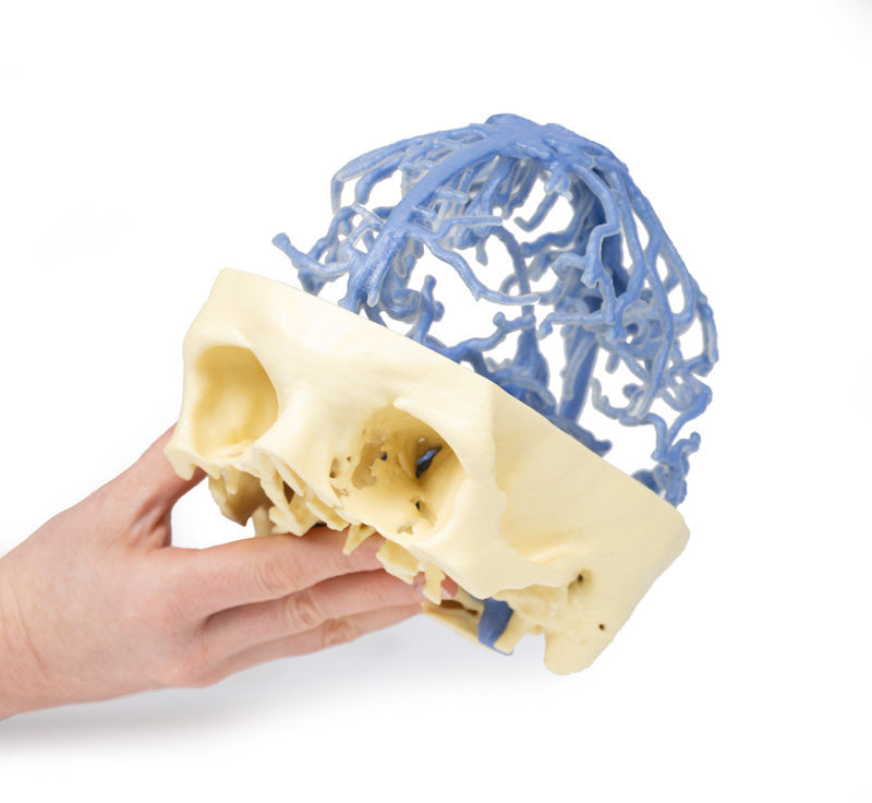 Venous Circulation | 3D Printed Cadaver