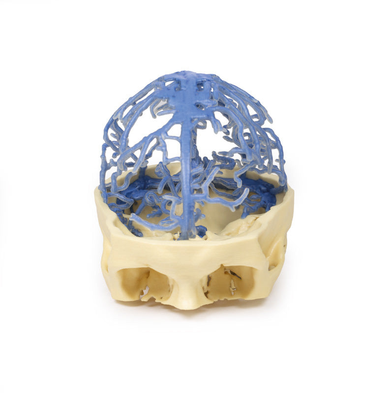 Venous Circulation | 3D Printed Cadaver