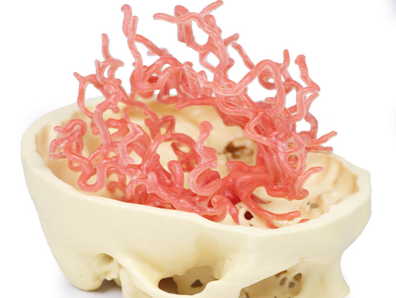 Arterial Circulation | 3D Printed Cadaver