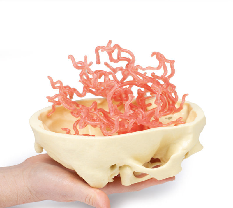 Arterial Circulation | 3D Printed Cadaver