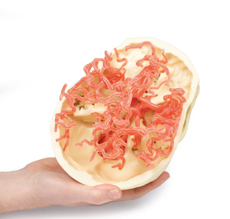 Arterial Circulation | 3D Printed Cadaver