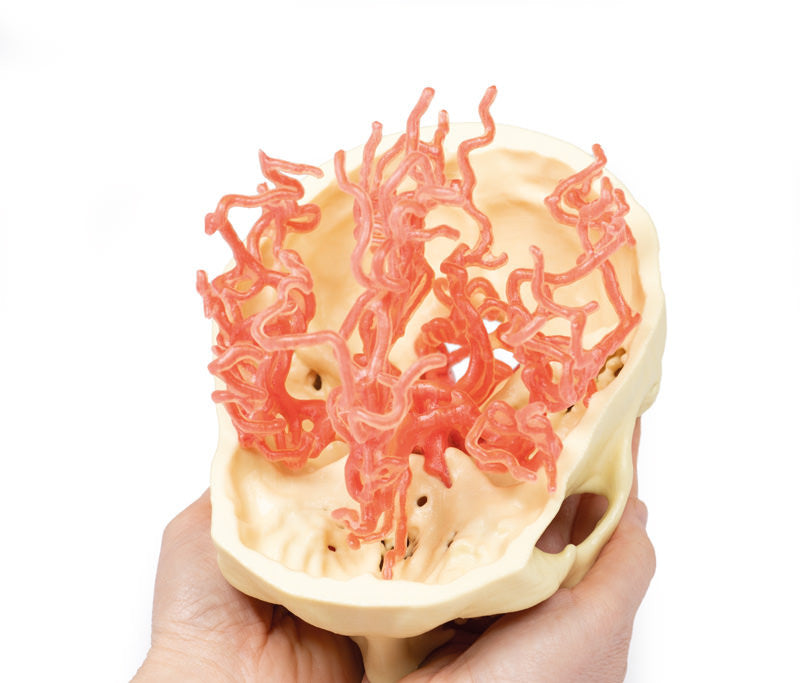 Arterial Circulation | 3D Printed Cadaver