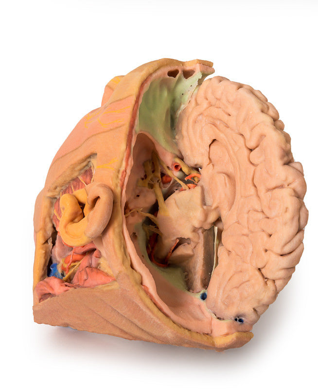 Head and Neck Replica - 3D Printed Cadaver