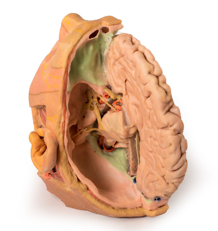 Head and Neck Replica - 3D Printed Cadaver