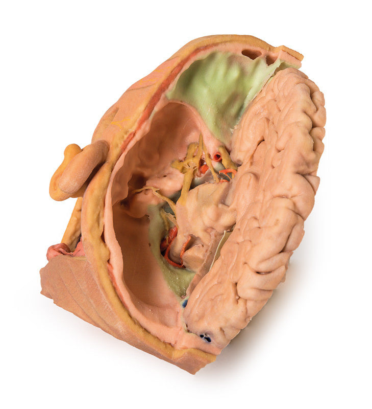 Head and Neck Replica - 3D Printed Cadaver
