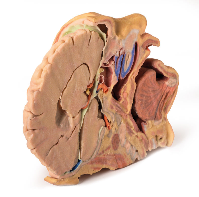 Head and Neck Replica - 3D Printed Cadaver