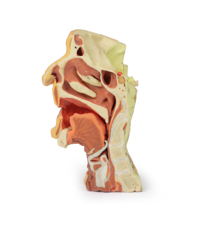 Deep face/Infratemporal fossa - 3D Printed Cadaver