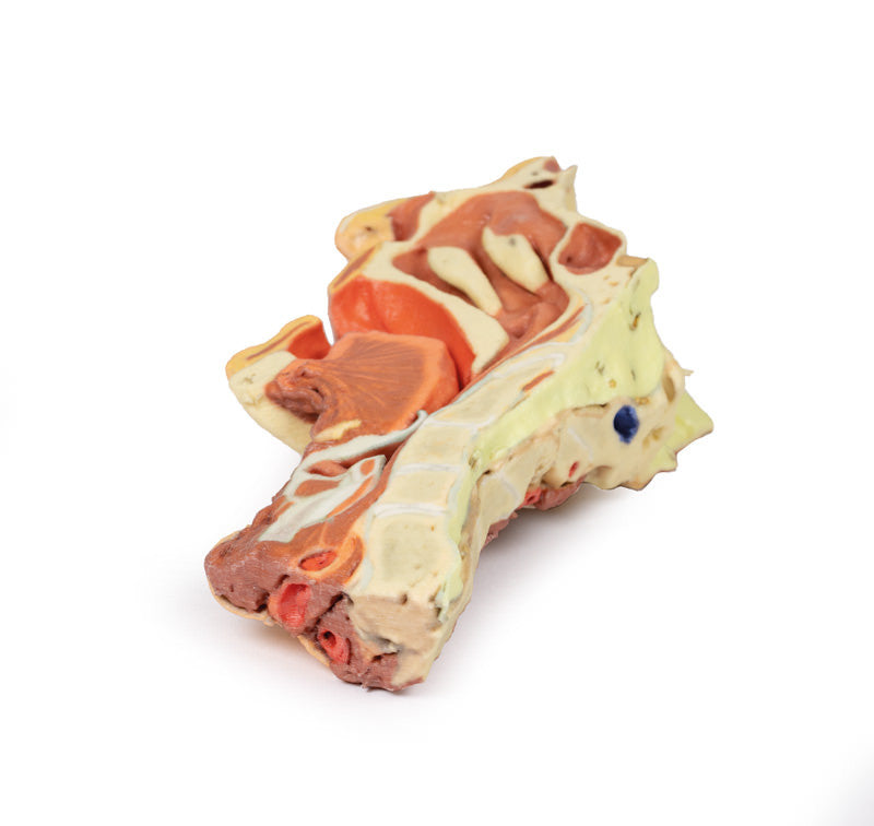Deep face/Infratemporal fossa - 3D Printed Cadaver