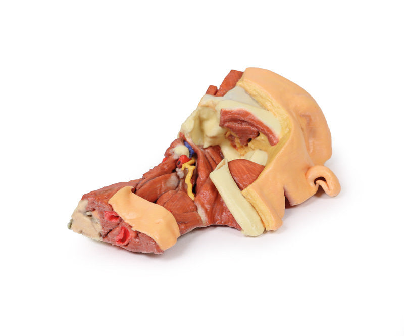 Deep face/Infratemporal fossa - 3D Printed Cadaver