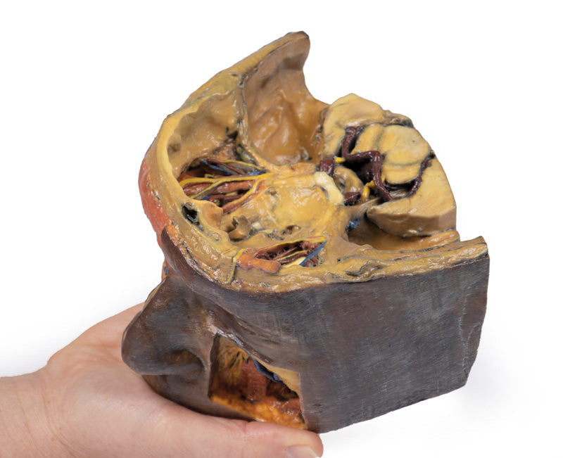 Superior Orbit - 3D Printed Cadaver