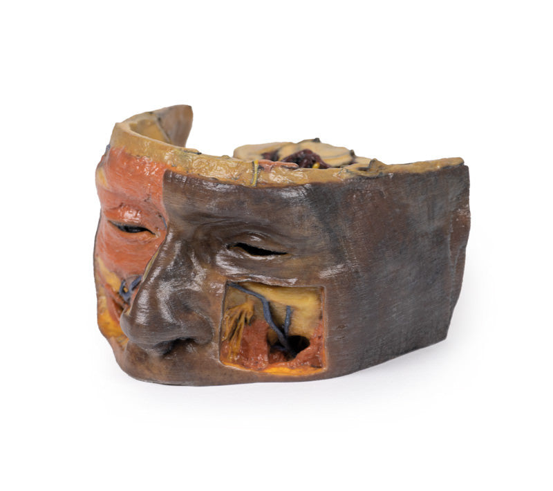 Superior Orbit - 3D Printed Cadaver