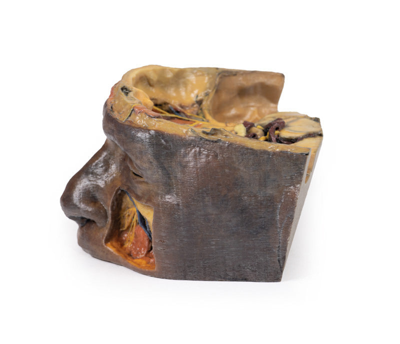 Superior Orbit - 3D Printed Cadaver