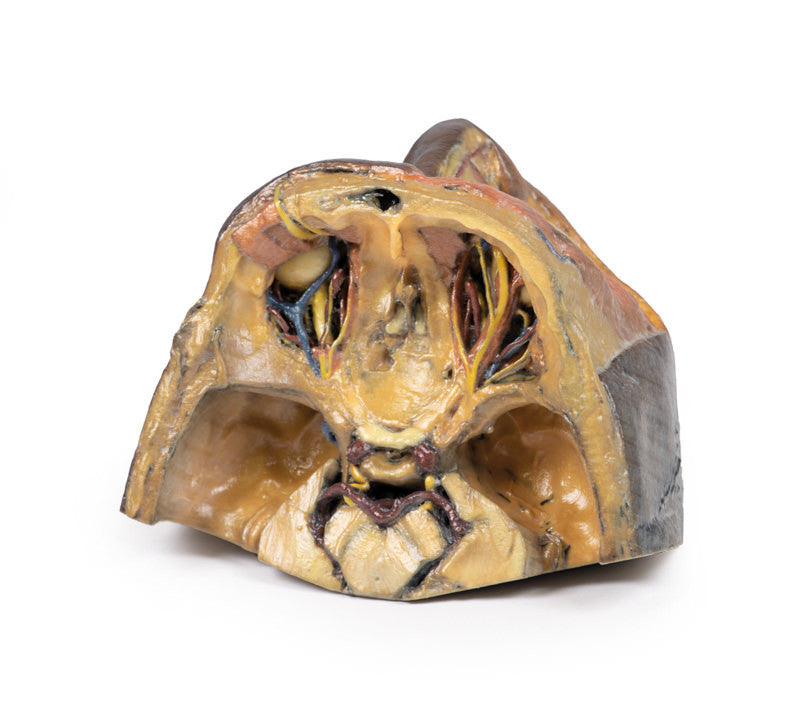 Superior Orbit - 3D Printed Cadaver