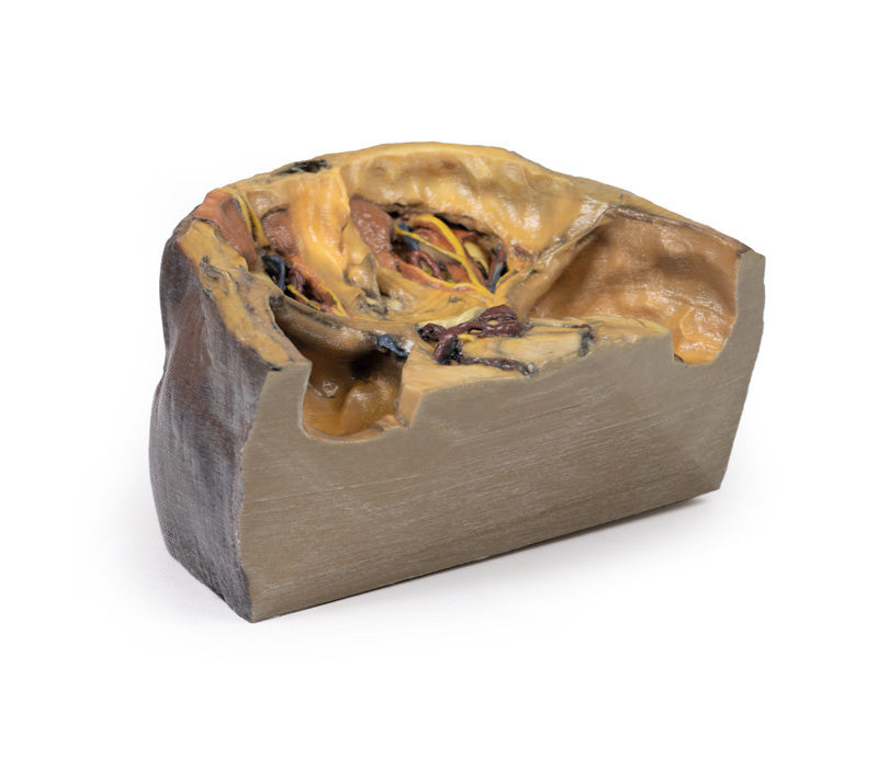 Superior Orbit - 3D Printed Cadaver