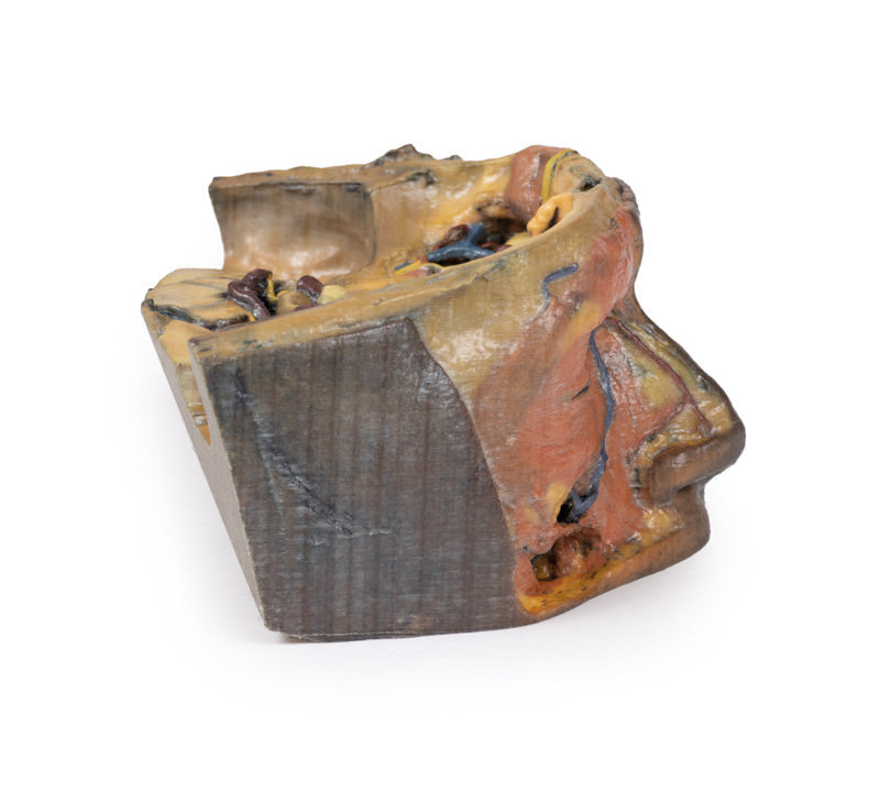 Superior Orbit - 3D Printed Cadaver