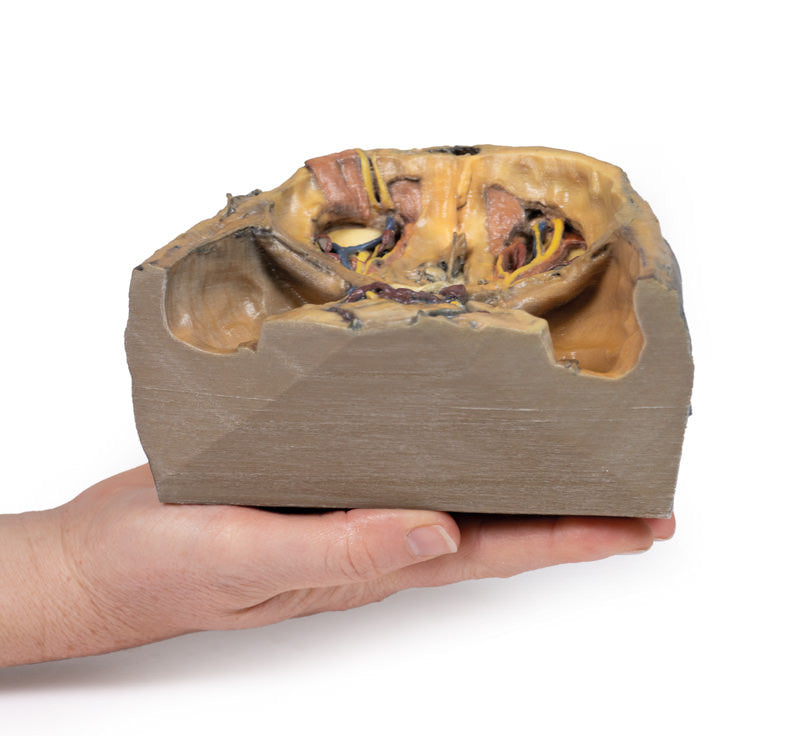 Superior Orbit - 3D Printed Cadaver
