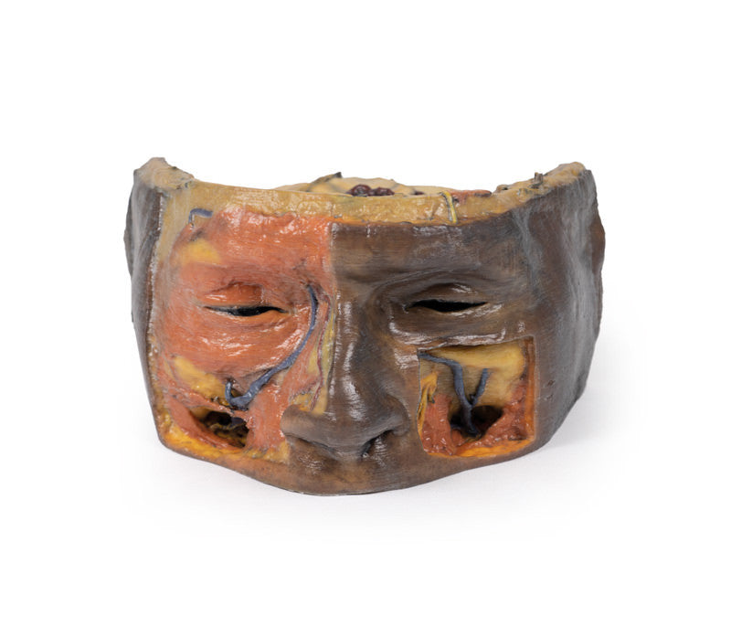 Superior Orbit - 3D Printed Cadaver