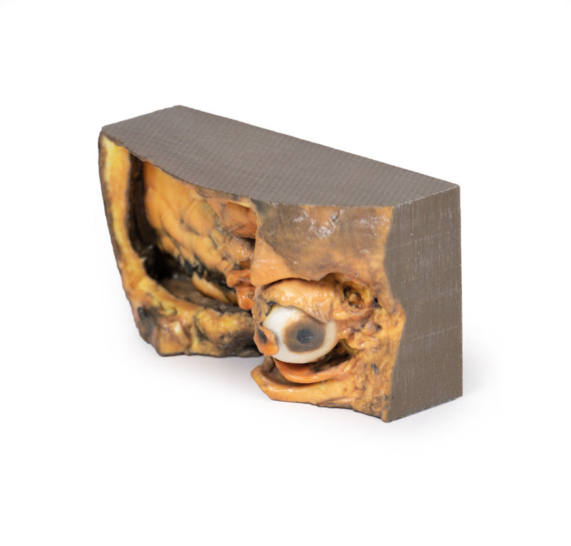 Lateral Orbit - 3D Printed Cadaver