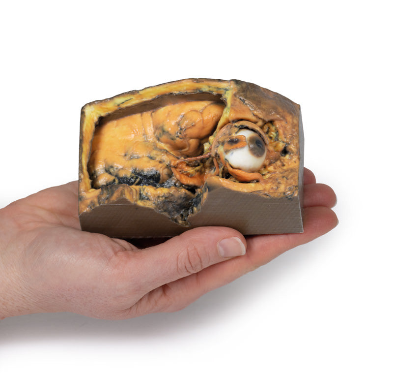 Lateral Orbit - 3D Printed Cadaver