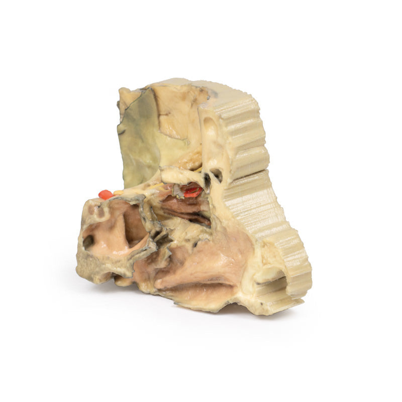 Medial Orbit - 3D Printed Cadaver