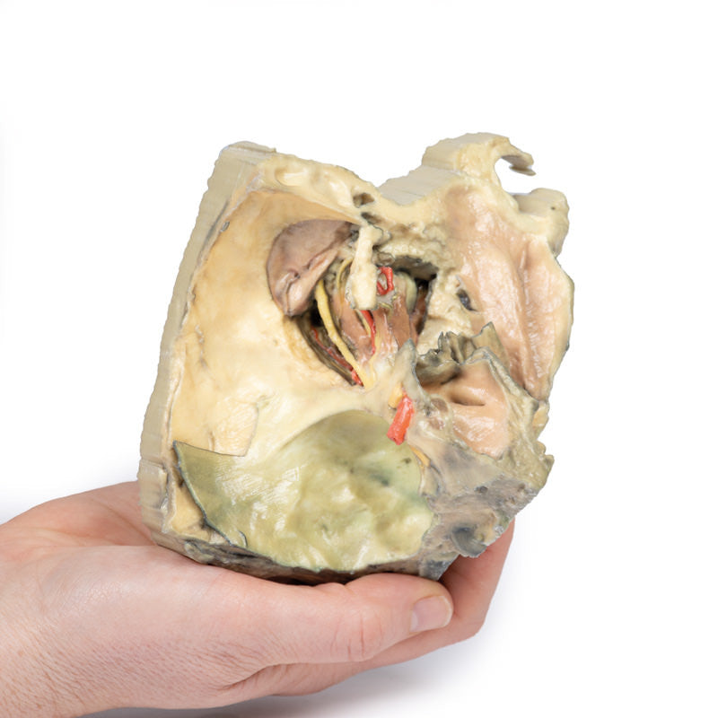Medial Orbit - 3D Printed Cadaver