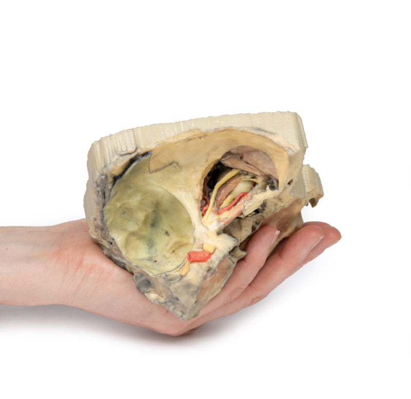 Medial Orbit - 3D Printed Cadaver