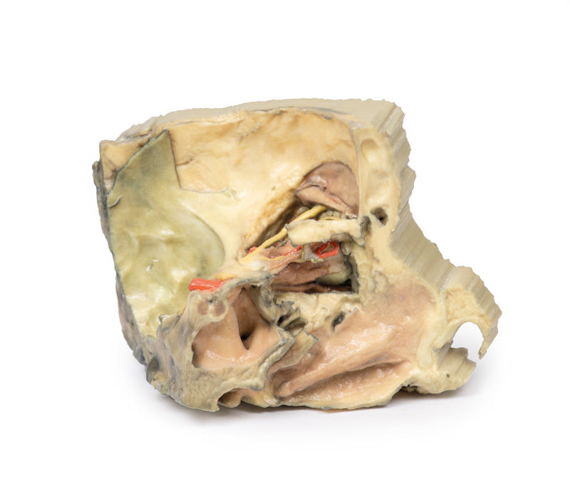 Medial Orbit - 3D Printed Cadaver