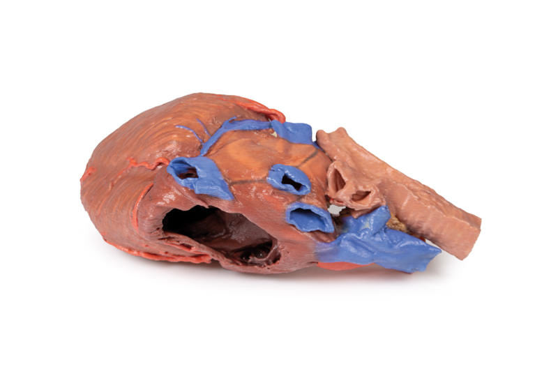 Heart and the distal trachea, carina and primary bronchi - 3D Printed Cadaver