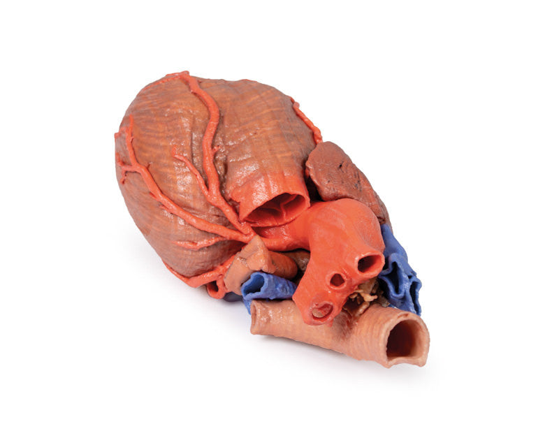 Heart and the distal trachea, carina and primary bronchi - 3D Printed Cadaver
