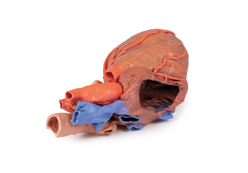 Heart and the distal trachea, carina and primary bronchi - 3D Printed Cadaver