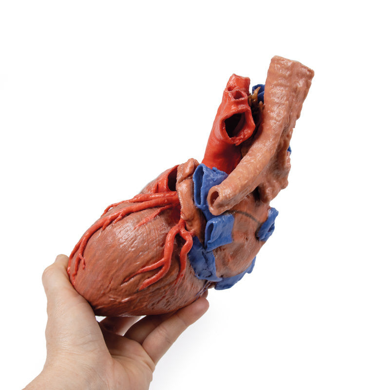 Heart and the distal trachea, carina and primary bronchi - 3D Printed Cadaver