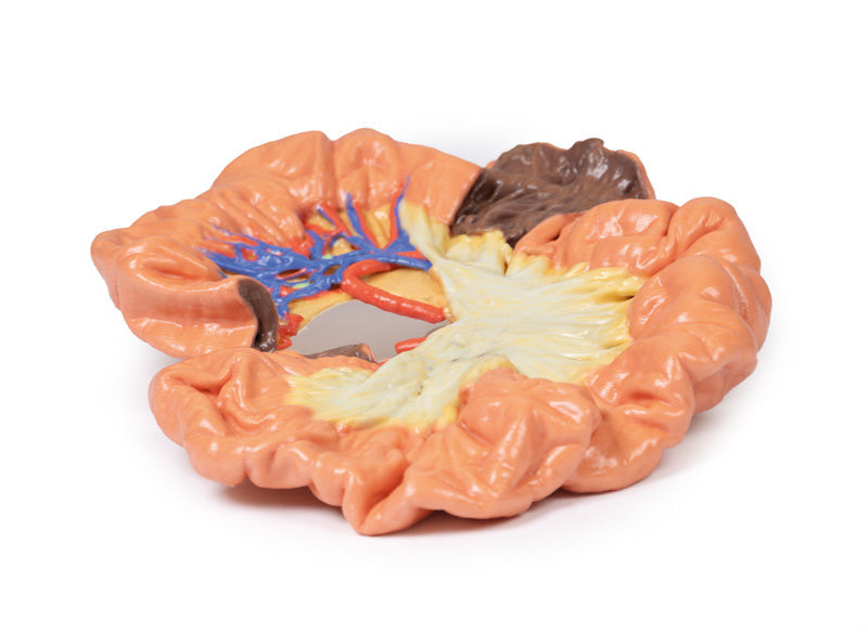 Bowel - Portion of Ileum - 3D Printed Cadaver