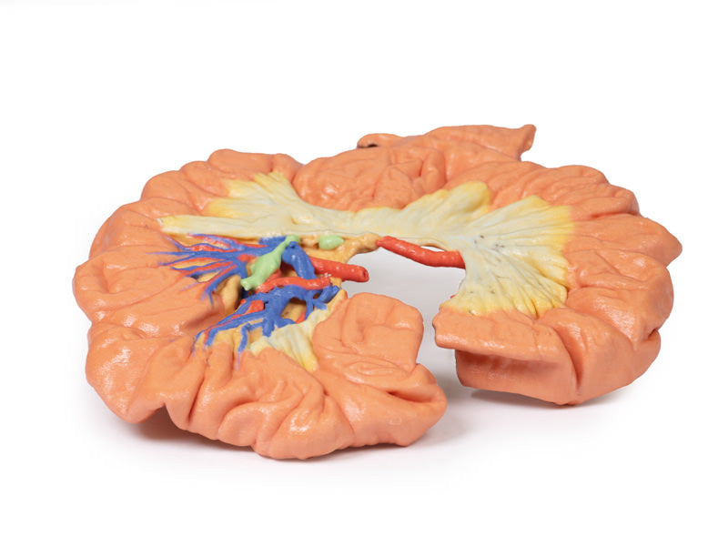 Bowel - Portion of Ileum - 3D Printed Cadaver
