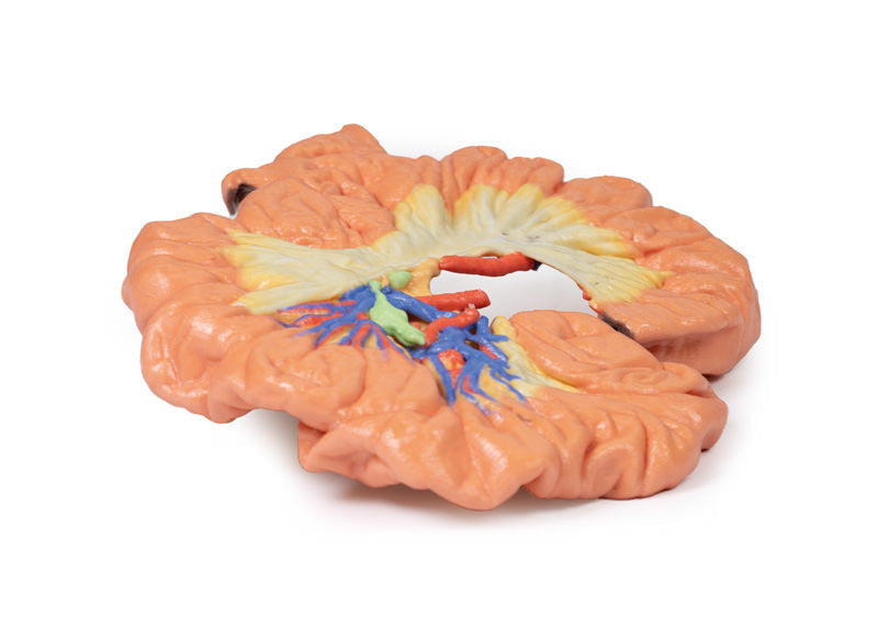 Bowel - Portion of Ileum - 3D Printed Cadaver