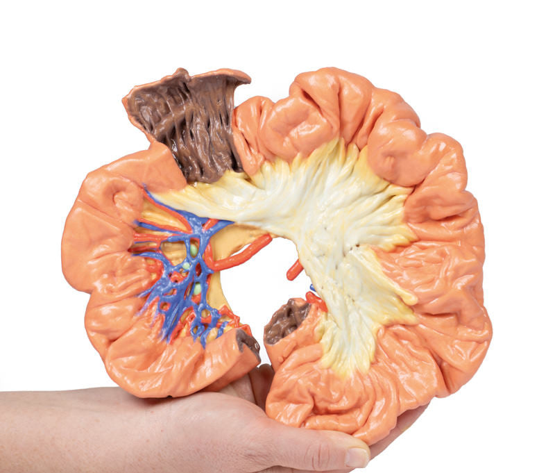 Bowel - Portion of Ileum - 3D Printed Cadaver